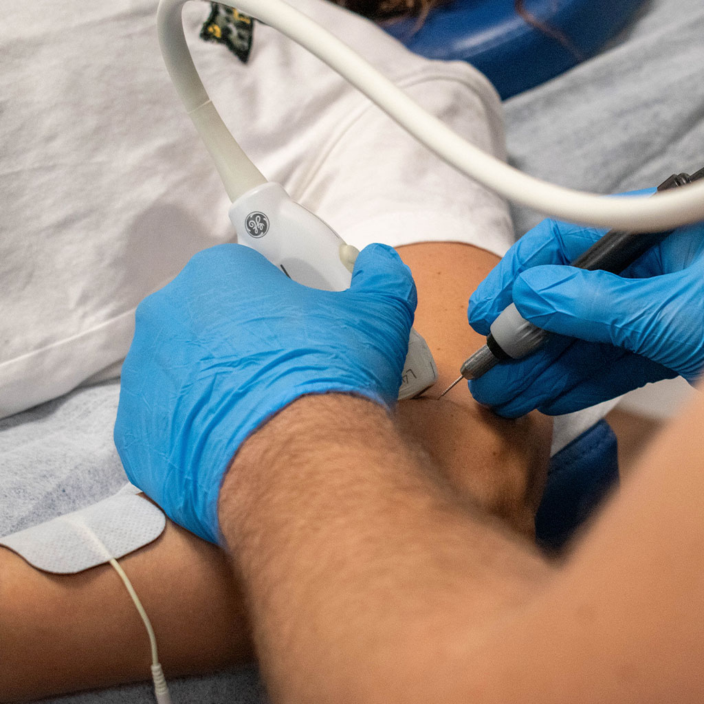Fisioterapia Invasiva EPI